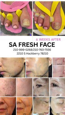 SA Fresh Face