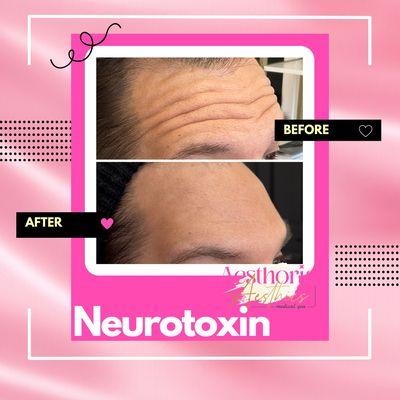 Aesthoria Aesthetics Medical Spa