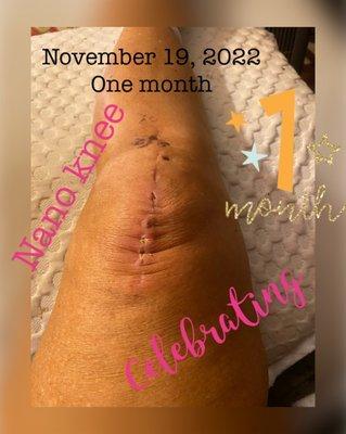 Thomas D Ferro, M D - Bone & Joint Center Arroyo