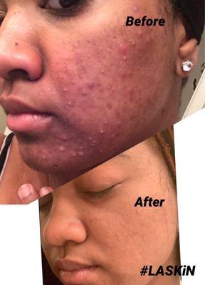 Next Step Weight Loss