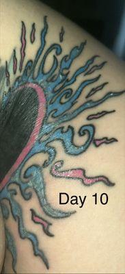 Day 10 of healing process. Paying attention to my finances redness and cloudy yellow areas. We can tell of possible scarring very displeased