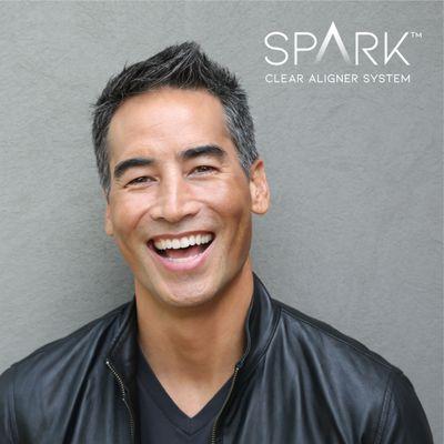 Spark Clear Aligners are the way to clearly align your teeth and bite and help resolve TMJ / TMD pain.