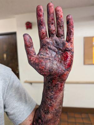 burnt bloody hand
special effects by Diana Tenes