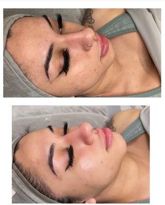 Simply skincare by Erika