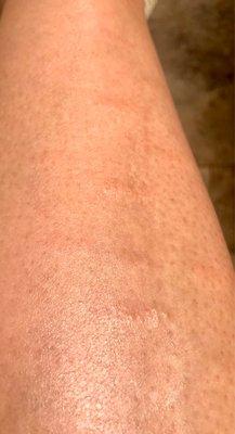 Avanti Body - Vacaville