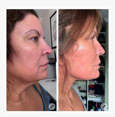 Starkman Facial Plastic & Laser Surgery