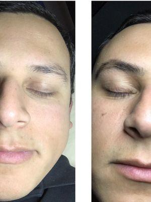 Just got my eyebrows and lashes tinted. I wasn't sure what to expect but they came out fantastic! Best place, totally recommended!