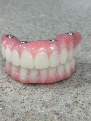denture conversion