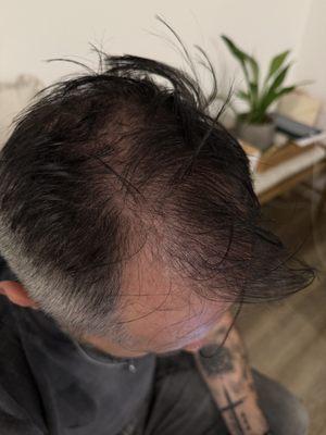 hair growth 1 session