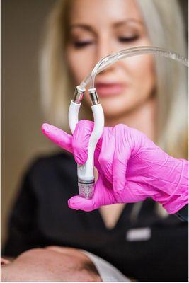 Simultaneous exfoliation, extractions and serum infusion.