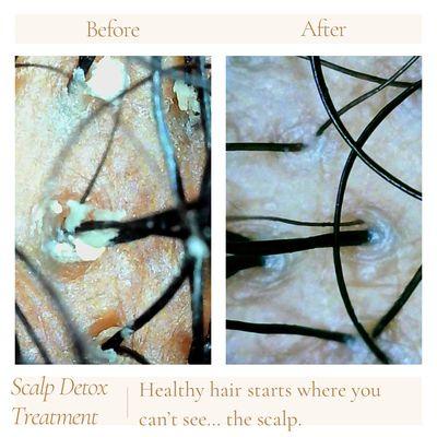 Stop treating the hair. Treat the scalp.