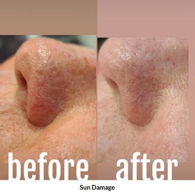 Phoenix Tattoo Removal and Med Spa