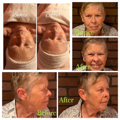 Oxygen face treatment with contour mask add on.