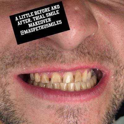 Maspeth USmiles Dental Care