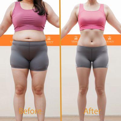 Venuv Diet Clinic