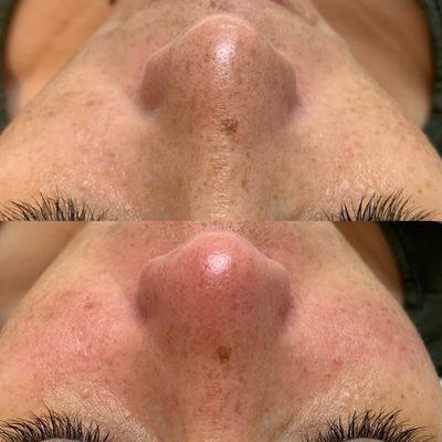 Deep Pore Cleansing Facial