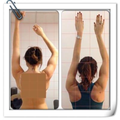 Results in just 5 treatments