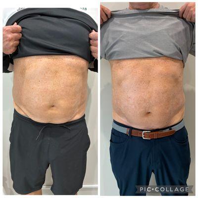A MALE'S VISIABLE CHANGE IN ABDOMINAL REGION BEFOR AND AFTER