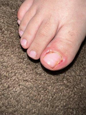 I took my daughter out for a pedicure and this is the result I'm very disappointed with this place. And this is the last time going there.