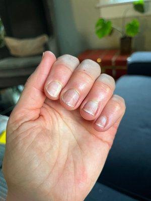 Face up hand, bent fingers showing nail beds