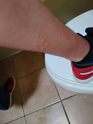 I've been staying at this hotel on weekends, at first everything was ok.. this is the second encounter with bed bugs . Stay clear yall