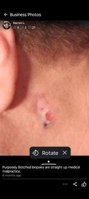 Peraza Dermatology Group