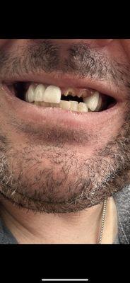 2 broken teeth and an abscess and was refused service for no reason