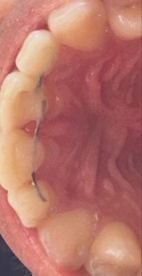 Longhorn Pediatric Dentistry and Orthodontics