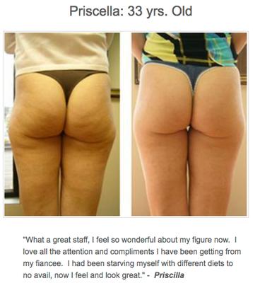 Total Body Aesthetic