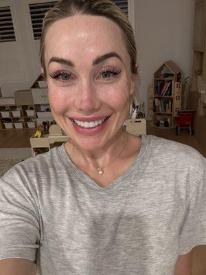 Dents/ hole/ cavities/ scar/ and lost cartilage for $25,000 to Dr. Frederick