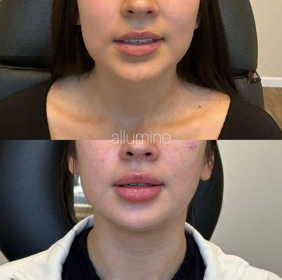 Allumine Skin Clinic