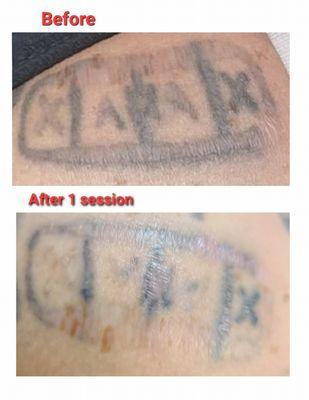 Before and after first session.