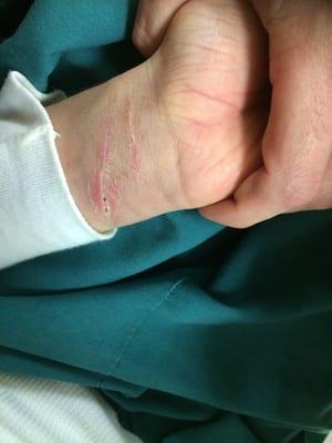 Lakeside Alternatives