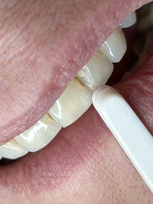 After photo of second poor repair job