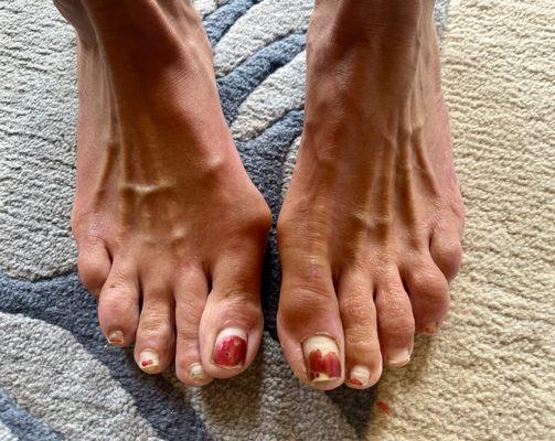 This is the before picture