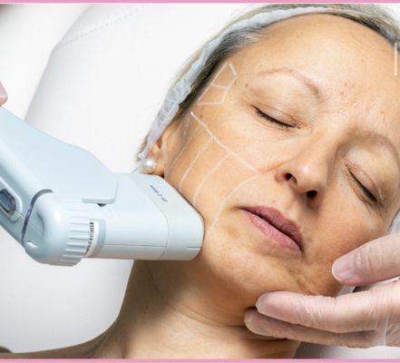 Skin Memoirs by Arianna