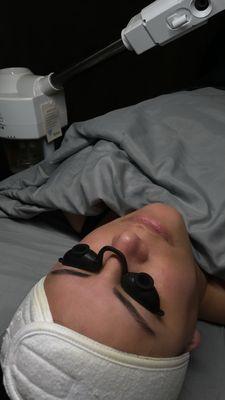 My skin during the facial