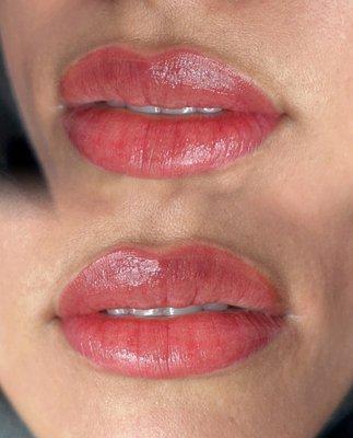 beautifly Aesthetics