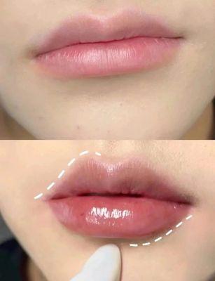 Natural Lips & Perfect Balance. That's the Lina, DNP promise. Expertly crafted enhancements for a refreshed, never-overdone look. Your mo