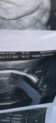 Bottom right corner says "female".