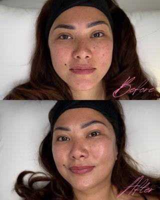 Visible results after one customized facial. No filters, no makeup -- real skin, real glow.