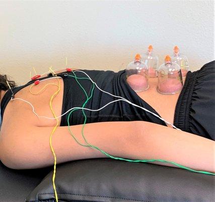 Forza Physiotherapy and Wellness
