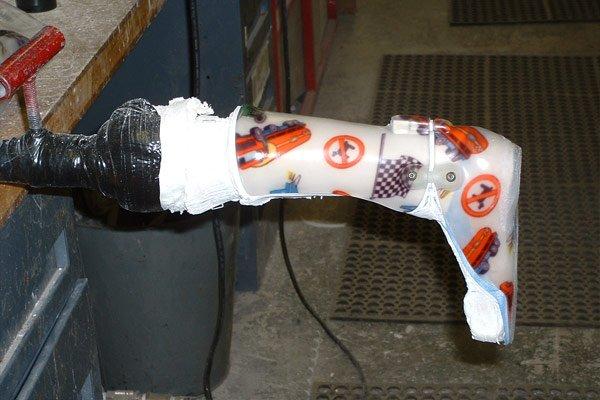 Advance Orthotic & Prosthetic Services, Inc.