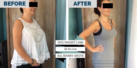 The Botox Bar & Wellness Medical Weight Loss