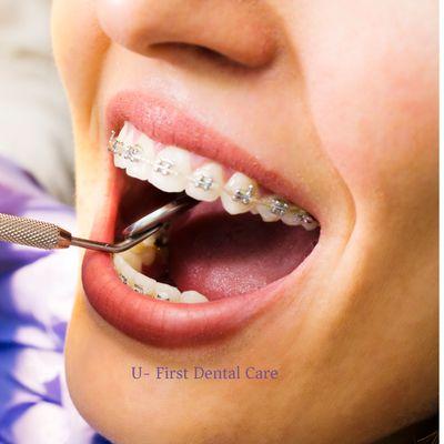 U-First Dental Care
