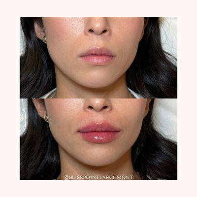 Natural and more proportionate.