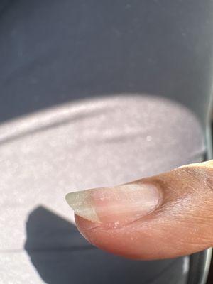A cut near my nail.
