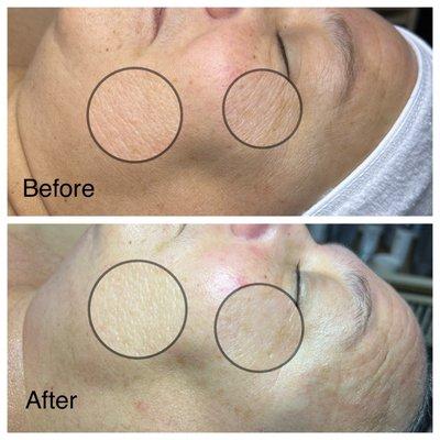 Firming Peptide facial