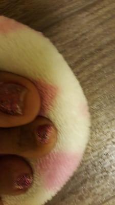 Toes were a mess not dry Joann