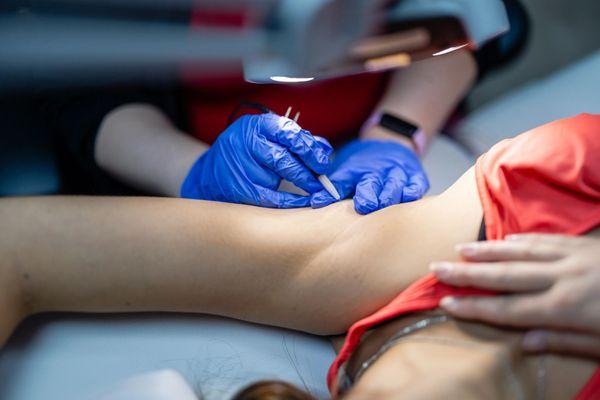 Smart Choice Electrolysis